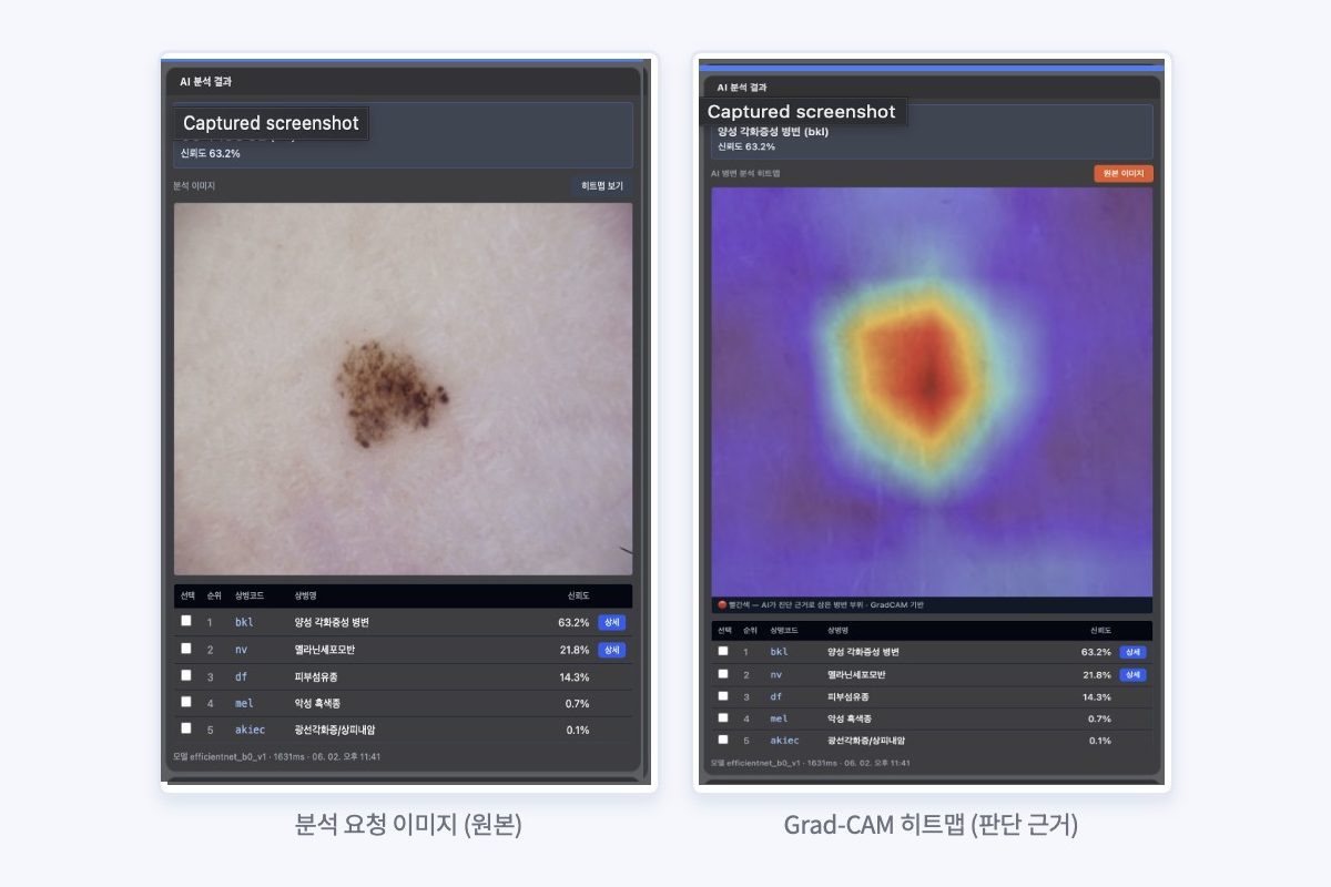 Artifact Medical AI 진료 화면